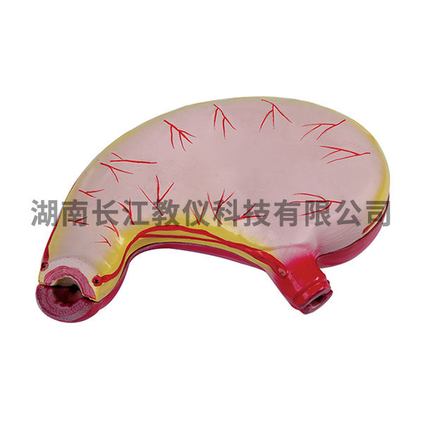 胃解剖模型